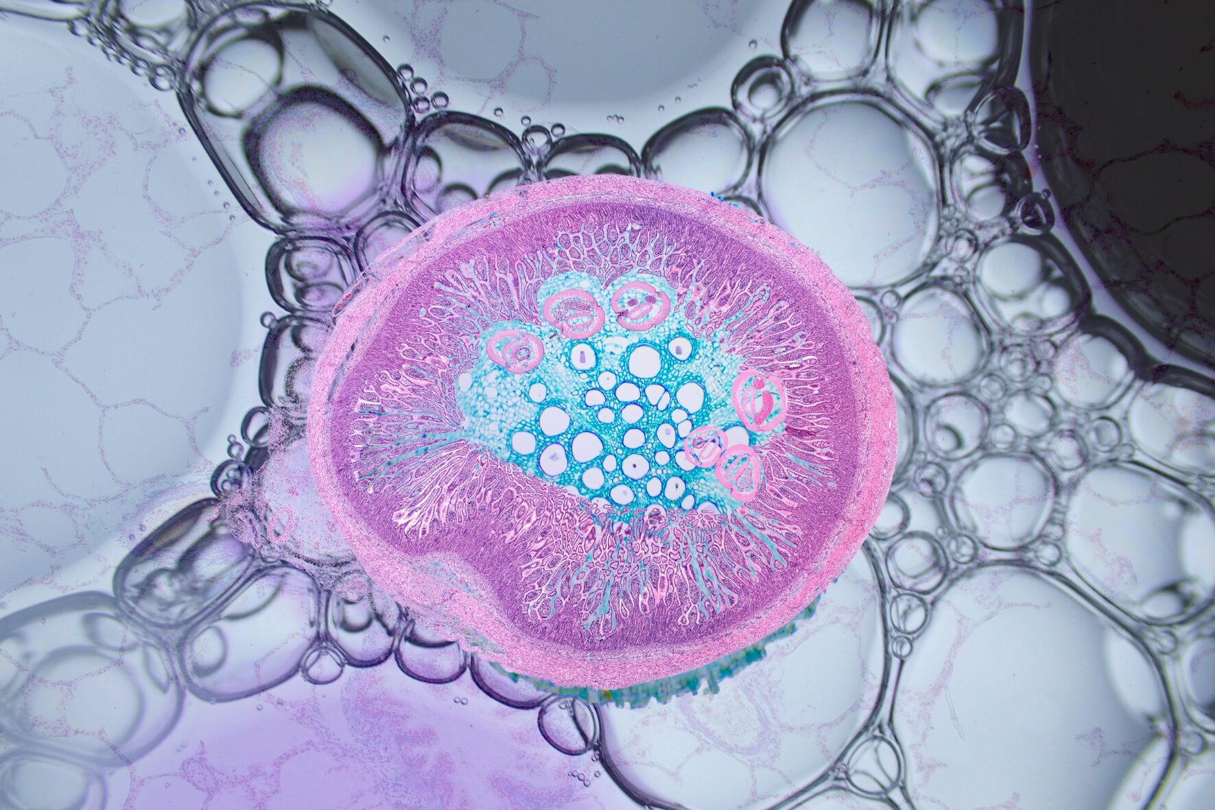 EXOSOMES